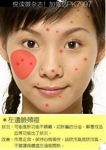 脸上各个部位长痘痘的原因和调理 (10)