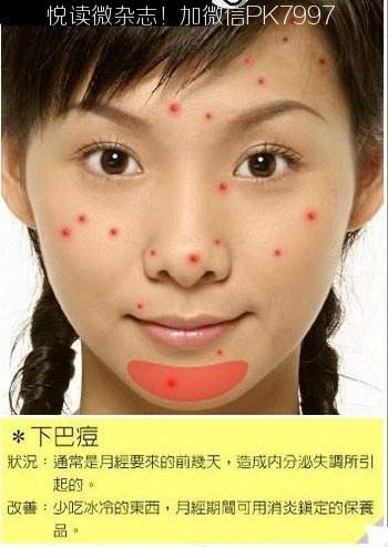 脸上各个部位长痘痘的原因和调理 (8)