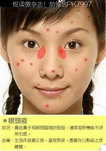 脸上各个部位长痘痘的原因和调理 (6)