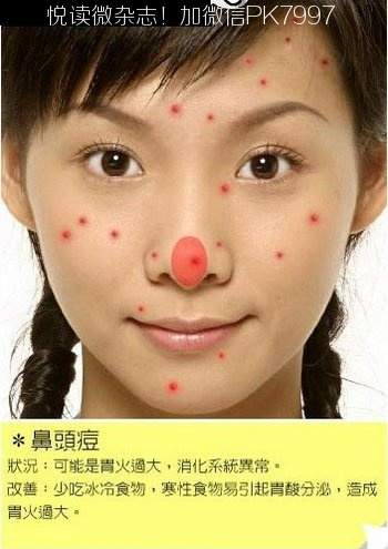 脸上各个部位长痘痘的原因和调理 (5)